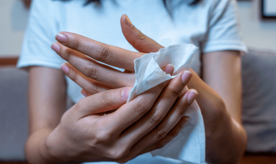 Patient wiping off topical treatment off their hands to prevent staining