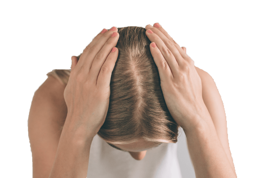 Patient with scalp irritation from plaque psoriasis